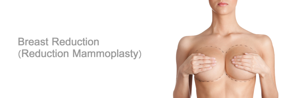 ماموپلاستی چیست