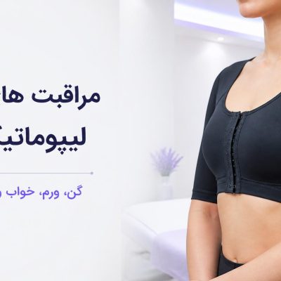 مراقبت های بعد از ساکشن بازو