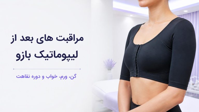 مراقبت های بعد از ساکشن بازو
