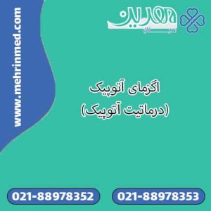 اگزمای آتوپیک (درماتیت آتوپیک)