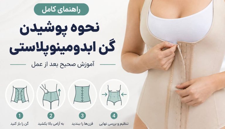 نحوه پوشیدن گن ابدومینوپلاستی | آموزش صحیح بعد از عمل
