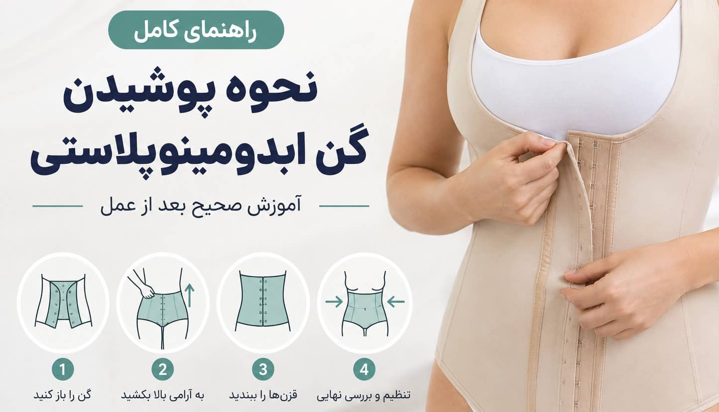 نحوه پوشیدن گن ابدومینوپلاستی | آموزش صحیح بعد از عمل