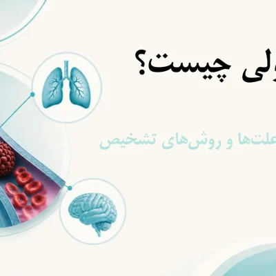 آمبولی چیست