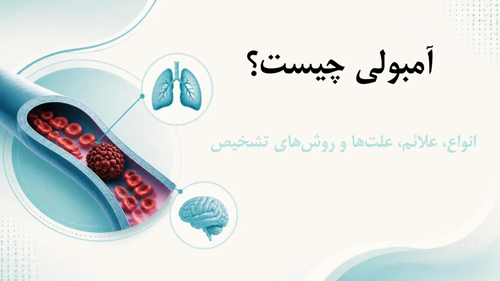 آمبولی چیست